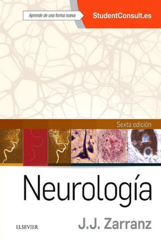 Zarranz, J.J., Neurología 6 ed. © 2018 R 2022