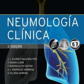 Álvarez sala, j.l., neumología clínica 2 ed. © 2016 r 2021