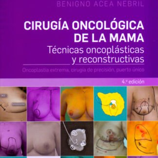 acea nebril, b., cirugía oncológica de la mama 4 ed. © 2018