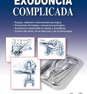 exodoncia complicada original.indd