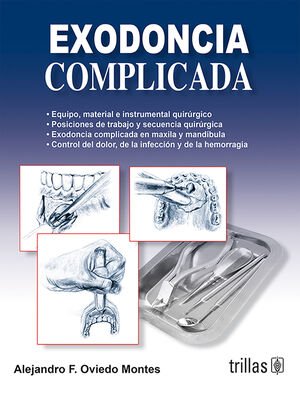 exodoncia complicada original.indd exodoncia complicada original.indd