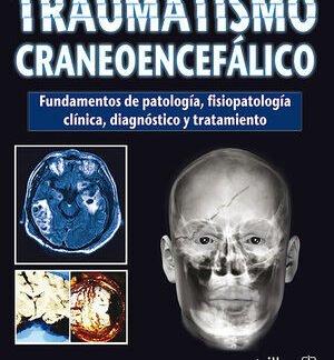traumatismo craneoencefalico.indd