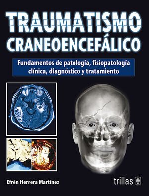 traumatismo craneoencefalico.indd traumatismo craneoencefalico.indd